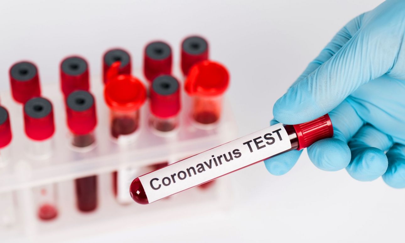 Koronavírus-teszt